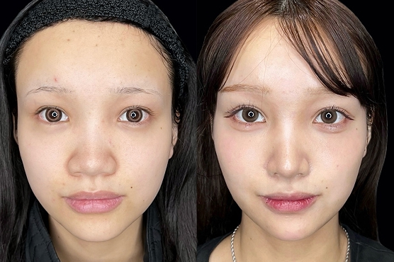 AiZクリニックが選ばれるポイント3