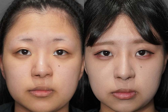 AiZクリニックが選ばれるポイント4