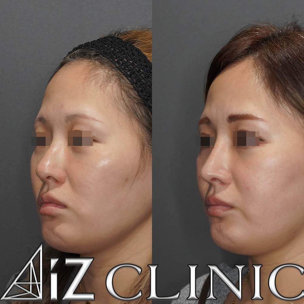 下からが大きく変わった一例