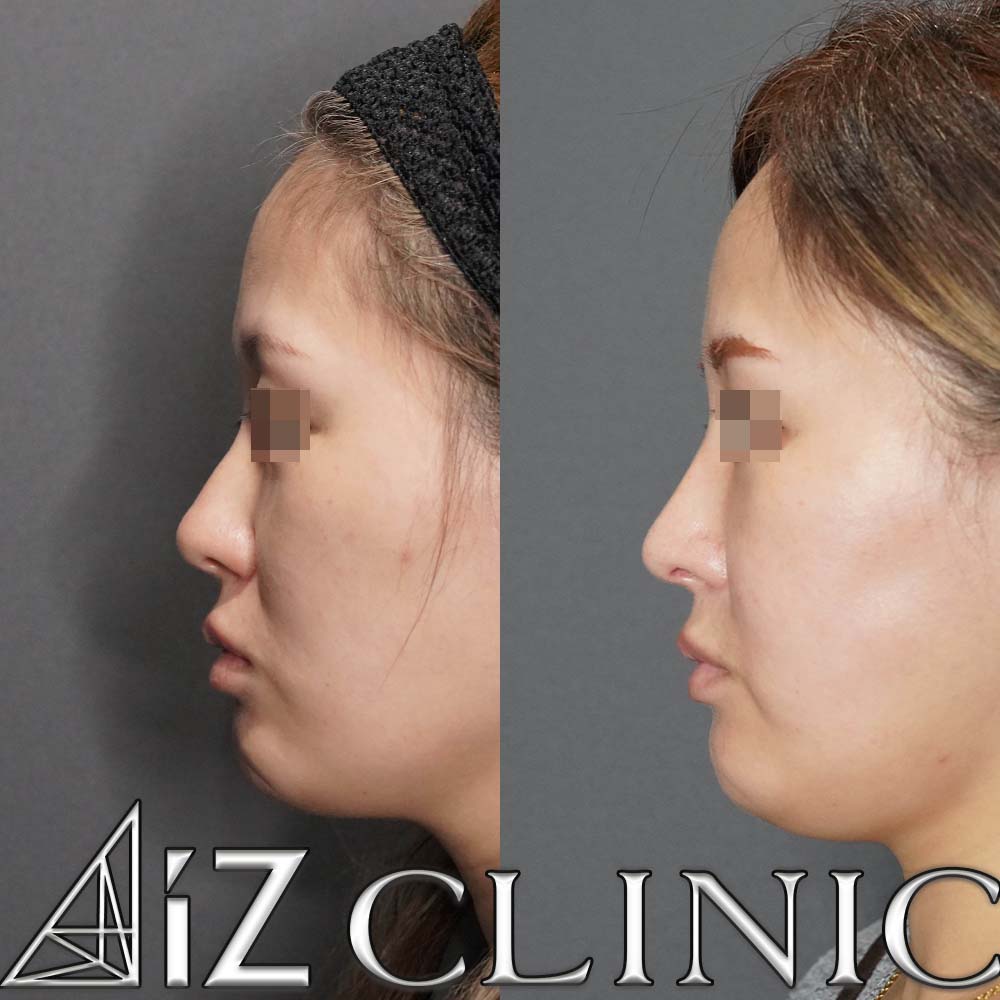 下からが大きく変わった一例