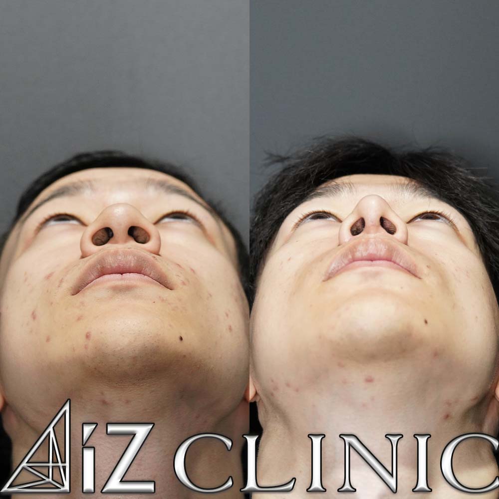 メンズ鼻の作り方