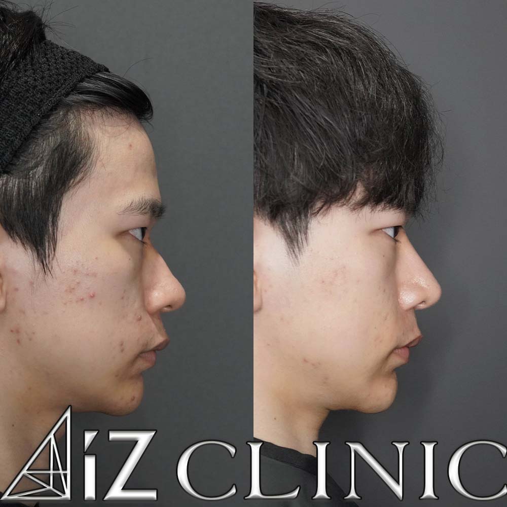 メンズ鼻の作り方