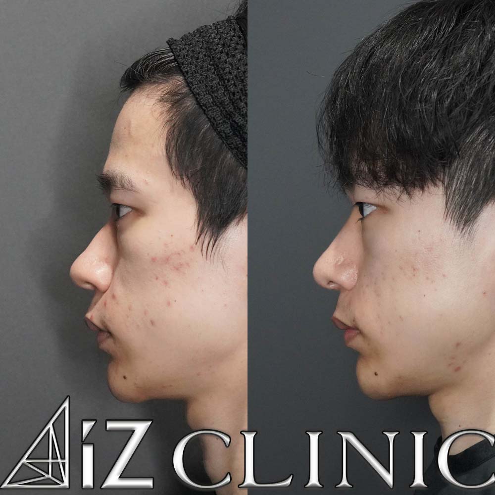 メンズ鼻の作り方