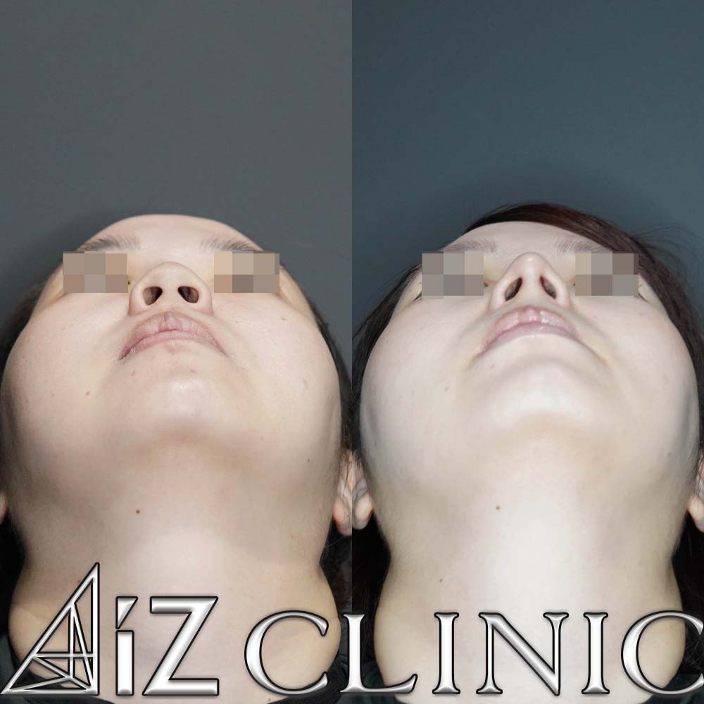 ナチュラルにしっかりとした変化を出した一例