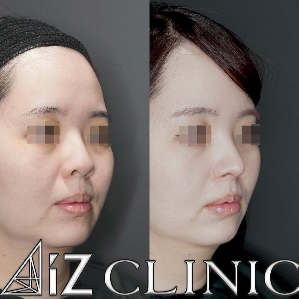 ナチュラルにしっかりとした変化を出した一例