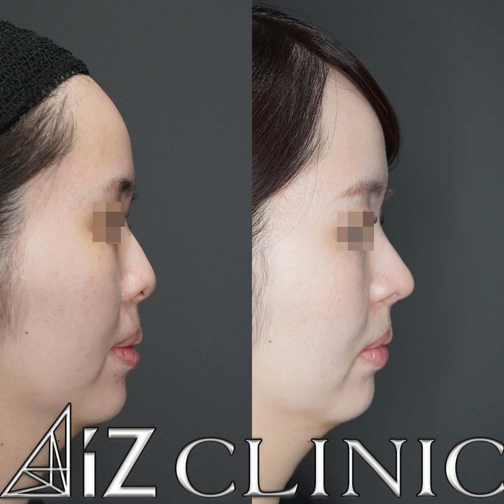 ナチュラルにしっかりとした変化を出した一例