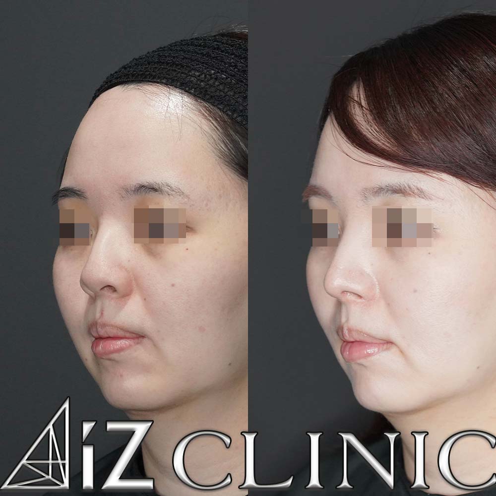 ナチュラルにしっかりとした変化を出した一例