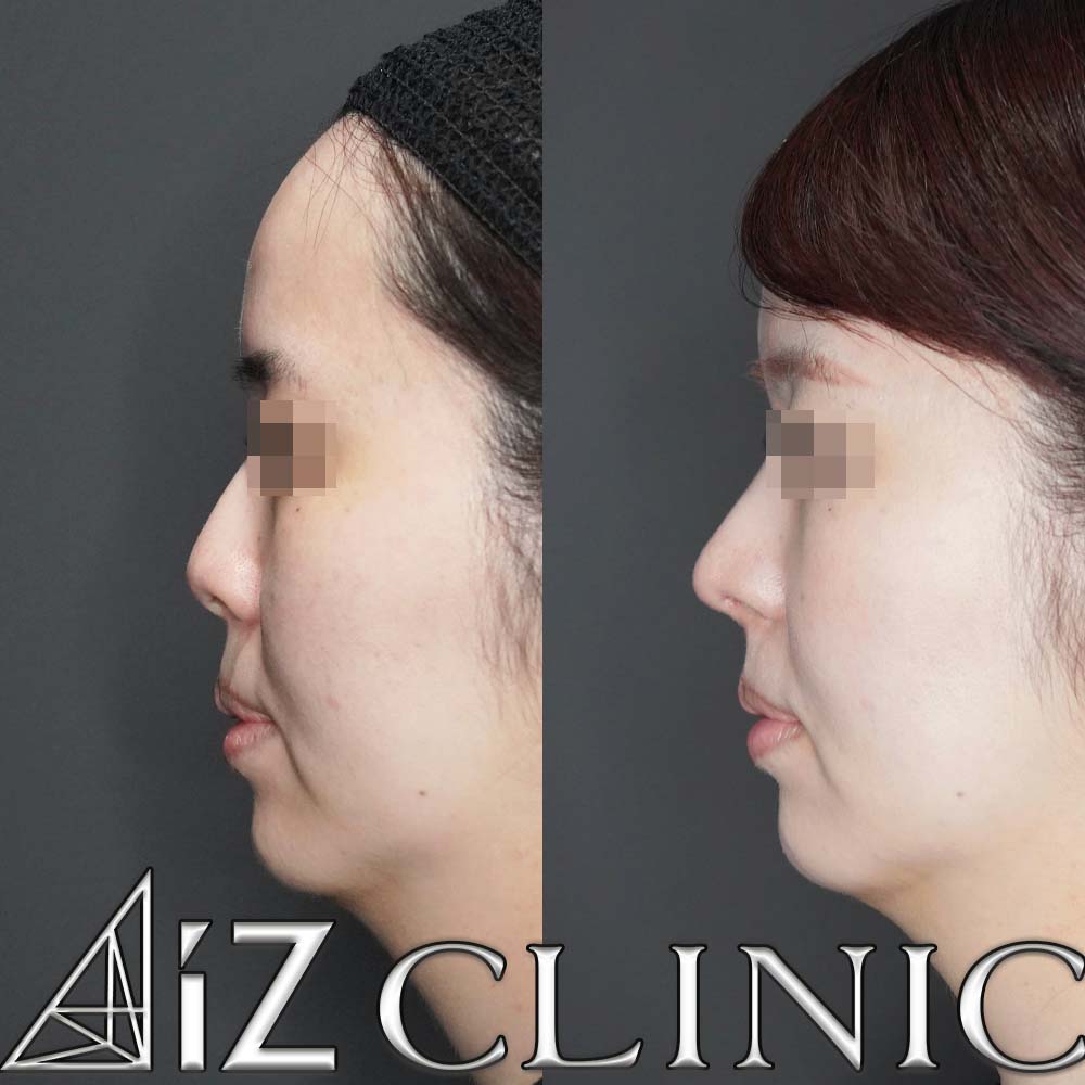 ナチュラルにしっかりとした変化を出した一例