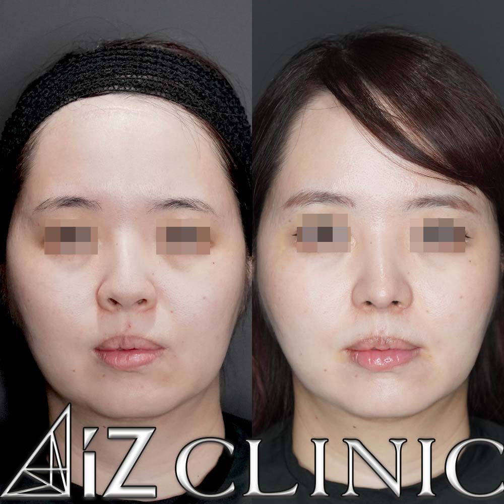 ナチュラルにしっかりとした変化を出した一例