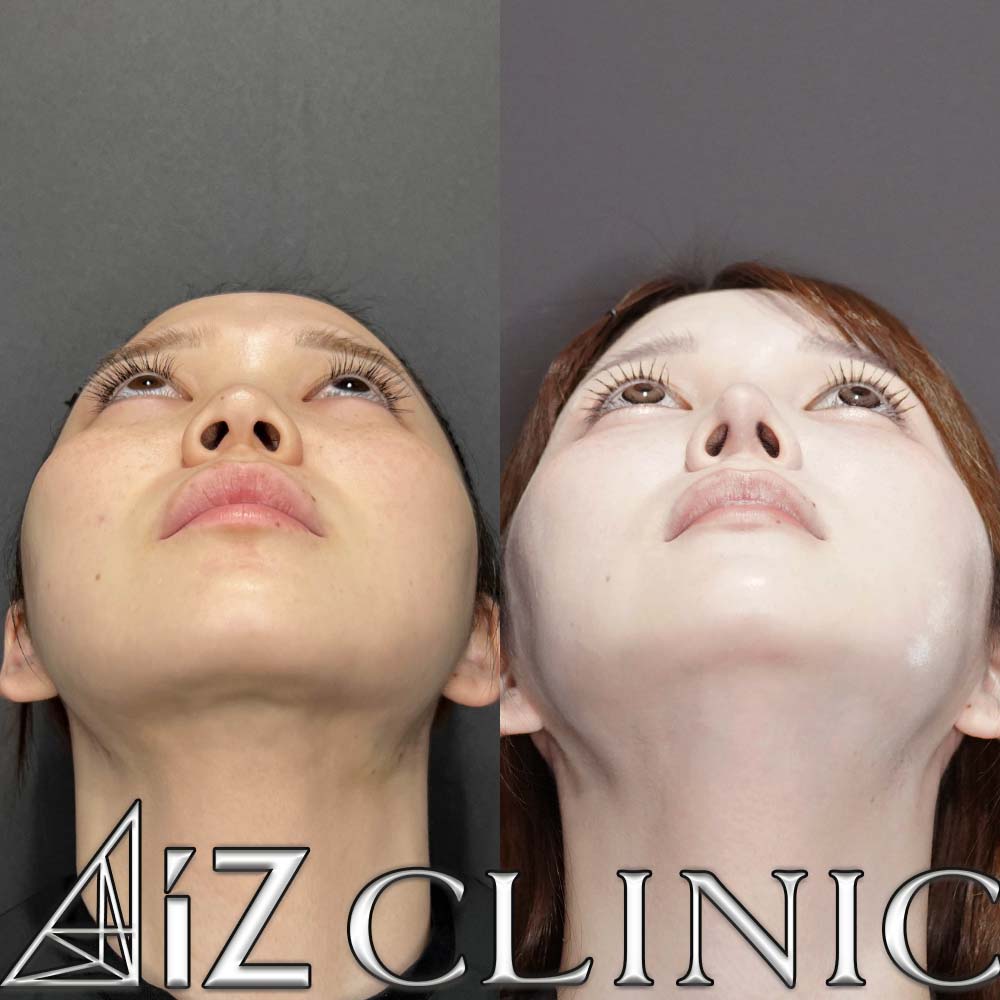加齢で鼻は大きくなる?原因・対策を徹底解説|美容外科・美容皮膚科「AiZクリニック(アイズクリニック)」|東京・港区・表参道